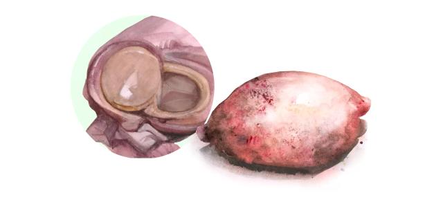 Фолликулярные и лютеиновые кисты у КРС