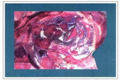 Колибактериоз птицы (колисептицемия)