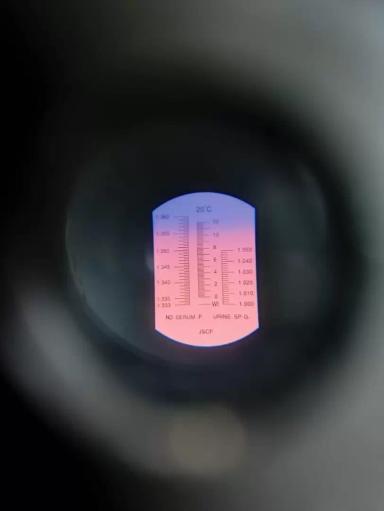 Вопросы из чатов: оптимален ли уровень иммуноглобулинов?