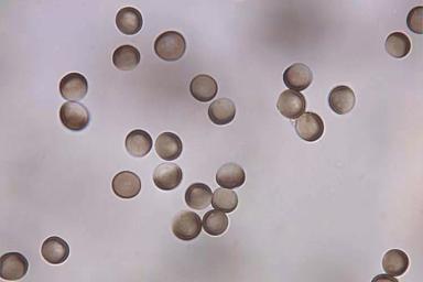 Твёрдая (каменная) головня ячменя