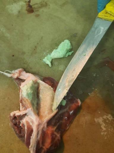 Актиномикоз