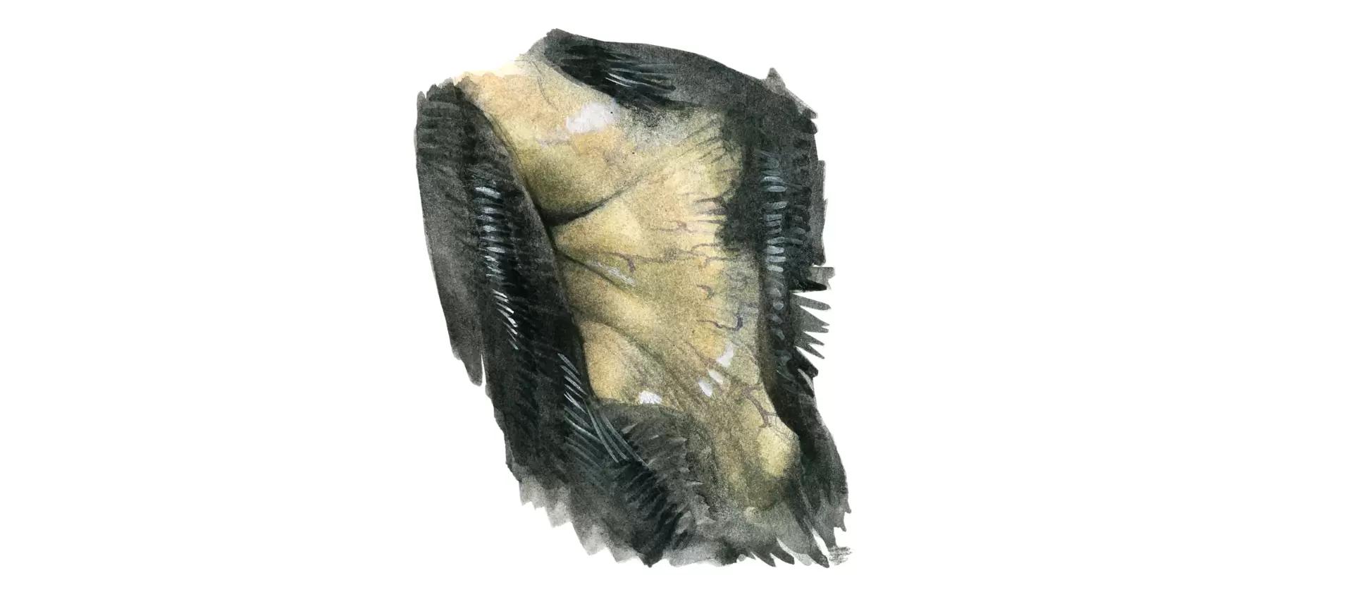 Отравление нитратами и нитритами