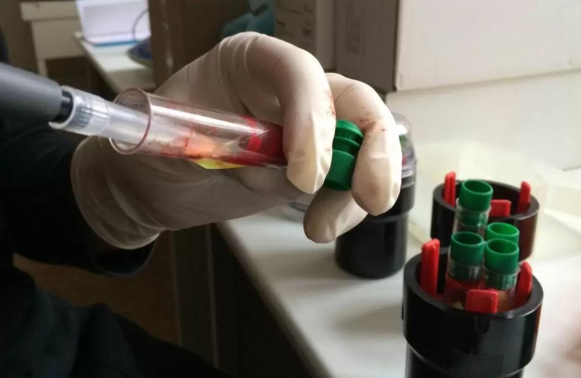 Инфекционный артрит-энцефалит коз. Как поставить верный диагноз