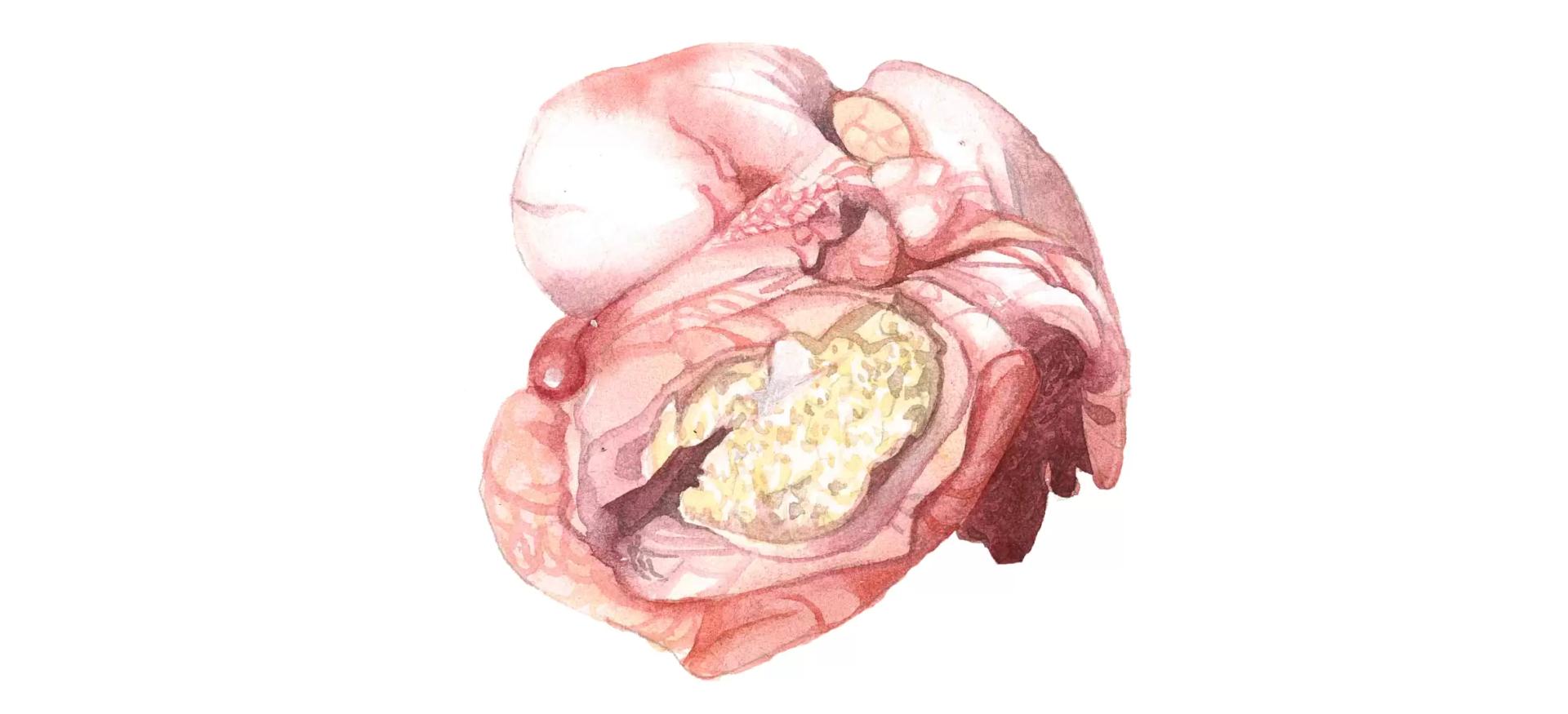 Травматический ретикулоперитонит и ретикулоперикардит у КРС