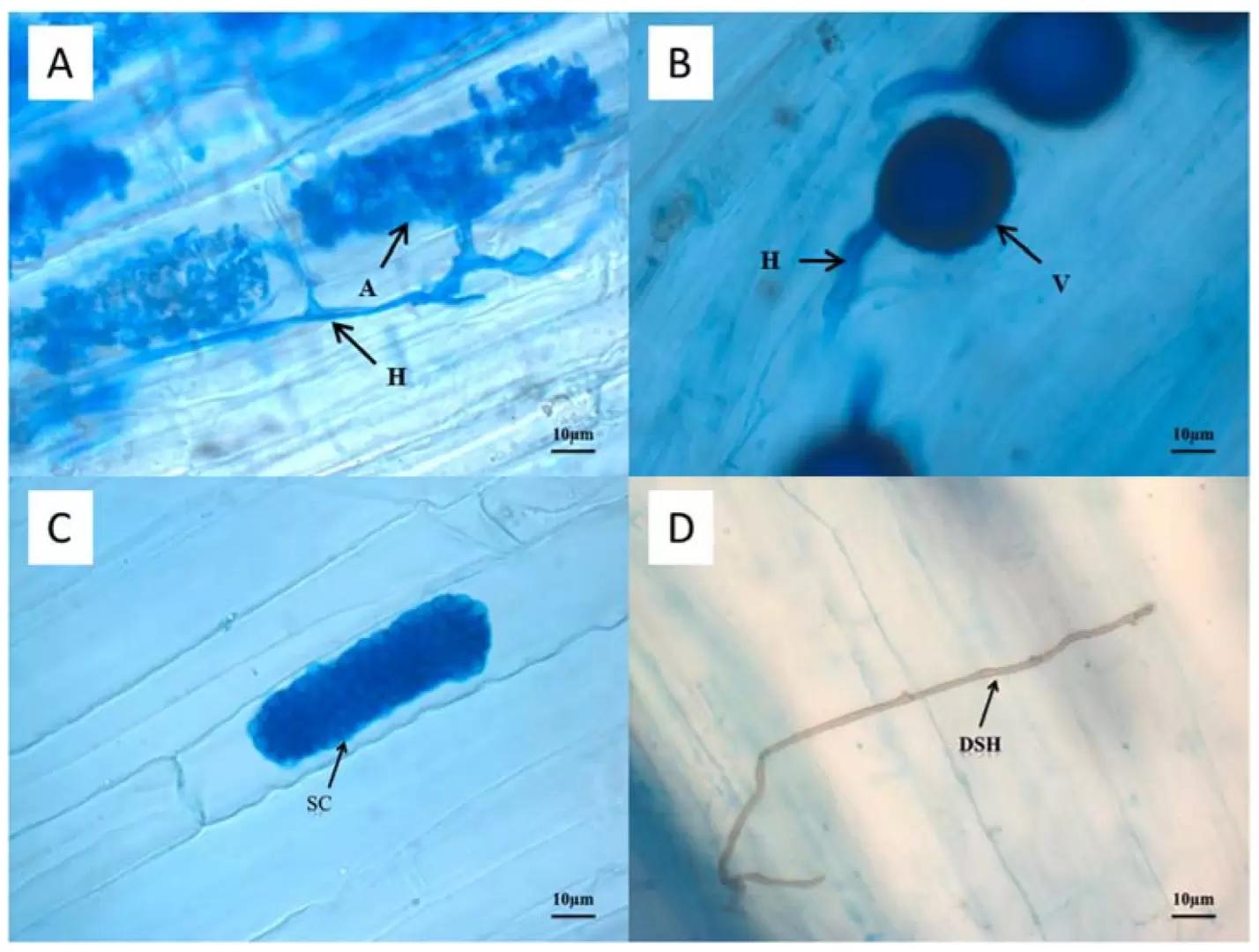 Кто живет в растениях? Или бактериальные и грибные эндофиты