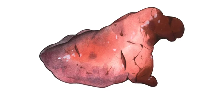 Микоплазменная (энзоотическая) пневмония свиней